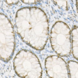 Invitrogen RbAp46 Recombinant Rabbit Monoclonal Antibody (3L1H6) 100 &mu;L;