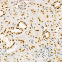 Invitrogen RbAp46 Recombinant Rabbit Monoclonal Antibody (3L1H6) 100 &mu;L;