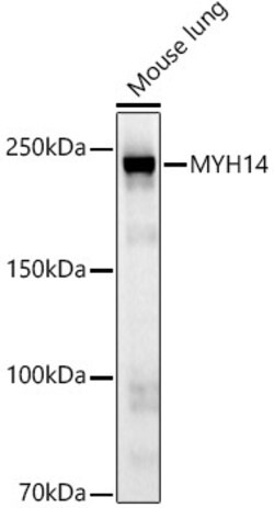 Invitrogen MYH14 Recombinant Rabbit Monoclonal Antibody (10E9C6) 100 &mu;L | Buy Online | Invitrogen&trade; | Fisher Scientific