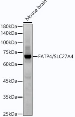 Invitrogen SLC27A4 Recombinant Rabbit Monoclonal Antibody (8D6S1) 100 &mu;L | Buy Online | Invitrogen&trade; | Fisher Scientific