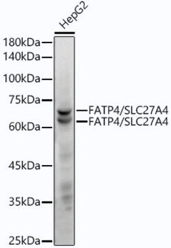 Invitrogen SLC27A4 Recombinant Rabbit Monoclonal Antibody (8D6S1) 100 &mu;L | Buy Online | Invitrogen&trade; | Fisher Scientific