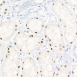 Invitrogen HNF1A Recombinant Rabbit Monoclonal Antibody (2Z4Z0) 100 &mu;L;