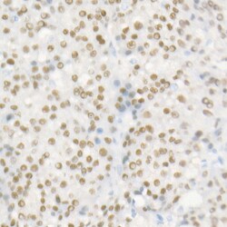 Invitrogen HNF1A Recombinant Rabbit Monoclonal Antibody (2Z4Z0) 100 &mu;L;