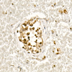 Invitrogen SMAD3 Recombinant Rabbit Monoclonal Antibody (5W8U8) 100 &mu;L | Buy Online | Invitrogen&trade; | Fisher Scientific