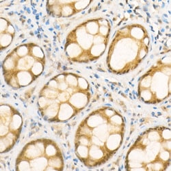 Invitrogen NOX4 Recombinant Rabbit Monoclonal Antibody (2B2K7) 100 &mu;L;
