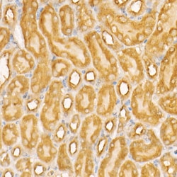 Invitrogen NOX4 Recombinant Rabbit Monoclonal Antibody (2B2K7) 100 &mu;L;