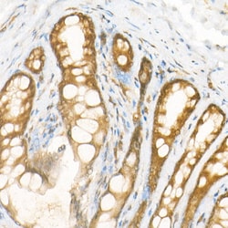 Invitrogen NOX4 Recombinant Rabbit Monoclonal Antibody (2B2K7) 100 &mu;L;