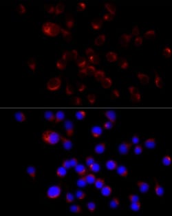Invitrogen NF-H Recombinant Rabbit Monoclonal Antibody (8D2S2) 100 &mu;L;