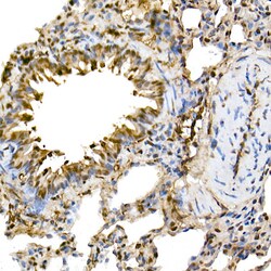 Invitrogen ERK1/ERK2 Recombinant Rabbit Monoclonal Antibody (9H6G8) 100