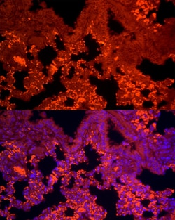 Invitrogen TGF beta-1 Recombinant Rabbit Monoclonal Antibody (4A4P3) 100