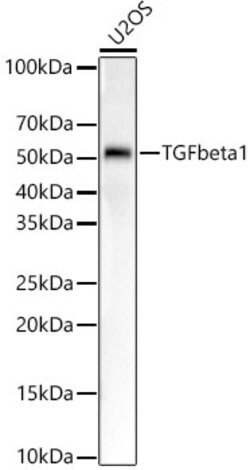 Invitrogen TGF beta-1 Recombinant Rabbit Monoclonal Antibody (4A4P3) 100