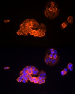 Invitrogen MMP13 Recombinant Rabbit Monoclonal Antibody (1W9V10) 100 &mu;L;