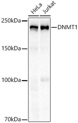Invitrogen DNMT1 Recombinant Rabbit Monoclonal Antibody (0Y4N7) 100 &mu;L | Buy Online | Invitrogen&trade; | Fisher Scientific