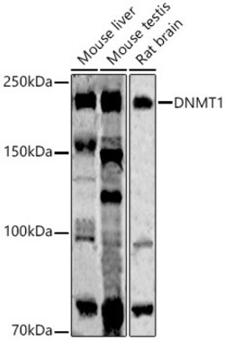 Invitrogen DNMT1 Recombinant Rabbit Monoclonal Antibody (0Y4N7) 100 &mu;L | Buy Online | Invitrogen&trade; | Fisher Scientific