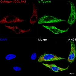 Invitrogen COL1A2 Recombinant Rabbit Monoclonal Antibody (5U8R0) 100 &mu;L;