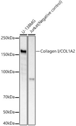 Invitrogen COL1A2 Recombinant Rabbit Monoclonal Antibody (5U8R0) 100 &mu;L;