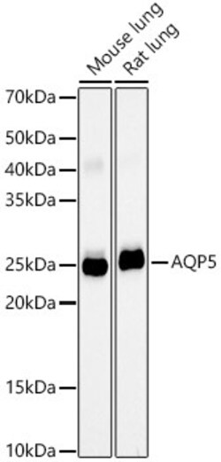 Invitrogen Aquaporin 5 Recombinant Rabbit Monoclonal Antibody (10V2Y1)
