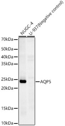 Invitrogen Aquaporin 5 Recombinant Rabbit Monoclonal Antibody (10V2Y1)