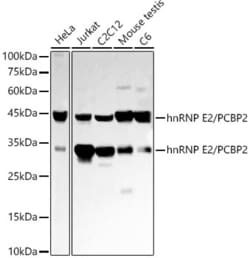 PCBP2 Recombinant Rabbit Monoclonal Antibody (3G2W10):Antibodies, Recombinant