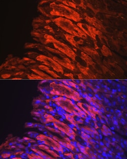 Invitrogen NQO1 Recombinant Rabbit Monoclonal Antibody (7L9B4) 100 &mu;L;
