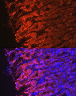 Invitrogen NQO1 Recombinant Rabbit Monoclonal Antibody (7L9B4) 100 &mu;L;