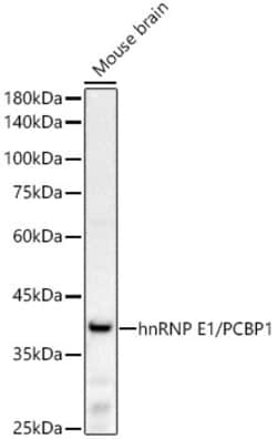 Invitrogen PCBP1 Recombinant Rabbit Monoclonal Antibody (7Y8C5) 100 &mu;L;