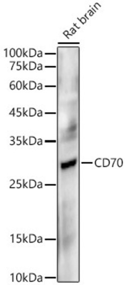 Invitrogen CD70 Recombinant Rabbit Monoclonal Antibody (0E6Y2) 100 &mu;L;