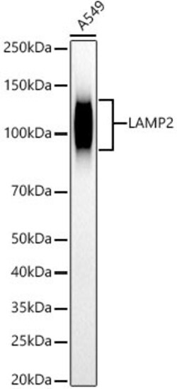 Invitrogen LAMP2 Recombinant Rabbit Monoclonal Antibody (5C1N2) 100 &mu;L | Buy Online | Invitrogen&trade; | Fisher Scientific