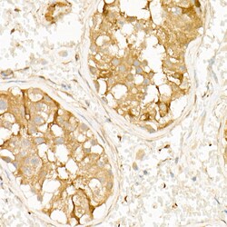 Invitrogen PKA beta Recombinant Rabbit Monoclonal Antibody (3P5F5) 100