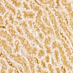 Invitrogen PKA beta Recombinant Rabbit Monoclonal Antibody (3P5F5) 100