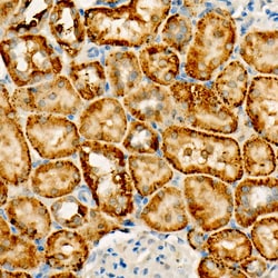 FUNDC1 Recombinant Rabbit Monoclonal Antibody (8W4R3):Antibodies, Recombinant
