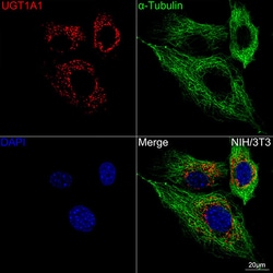 UGT1A1 Recombinant Rabbit Monoclonal Antibody (4R6Q0):Antibodies, Recombinant
