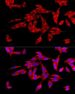 UGT1A1 Recombinant Rabbit Monoclonal Antibody (4R6Q0):Antibodies, Recombinant