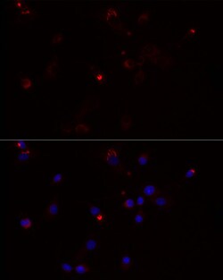 Invitrogen MMP3 Recombinant Rabbit Monoclonal Antibody (1X9N2) 100 &mu;L;