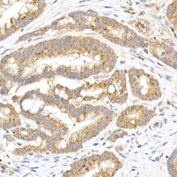 Invitrogen MMP3 Recombinant Rabbit Monoclonal Antibody (1X9N2) 100 &mu;L;