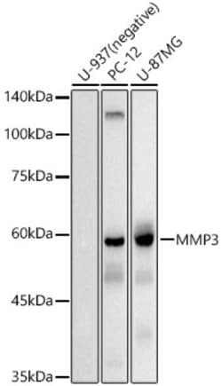 Invitrogen MMP3 Recombinant Rabbit Monoclonal Antibody (1X9N2) 100 &mu;L;