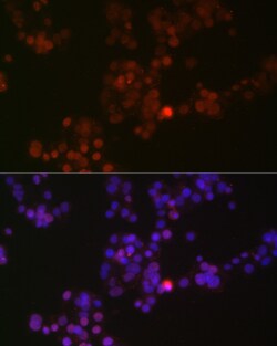 Phospho-p38 MAPK alpha (Tyr182) Recombinant Rabbit Monoclonal Antibody