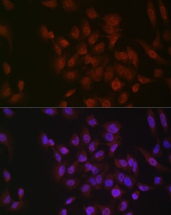 Phospho-p38 MAPK alpha (Tyr182) Recombinant Rabbit Monoclonal Antibody