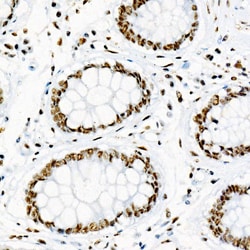 Phospho-p38 MAPK alpha (Tyr182) Recombinant Rabbit Monoclonal Antibody