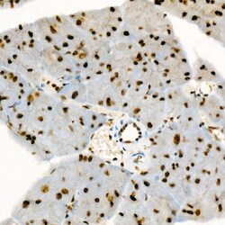 Phospho-p38 MAPK alpha (Tyr182) Recombinant Rabbit Monoclonal Antibody