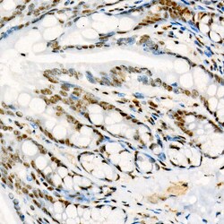 Phospho-p38 MAPK alpha (Tyr182) Recombinant Rabbit Monoclonal Antibody