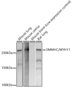 Invitrogen MYH11 Recombinant Rabbit Monoclonal Antibody (8L7K9) 100 &mu;L;