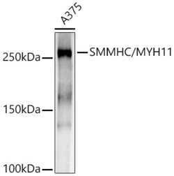 Invitrogen MYH11 Recombinant Rabbit Monoclonal Antibody (8L7K9) 100 &mu;L;