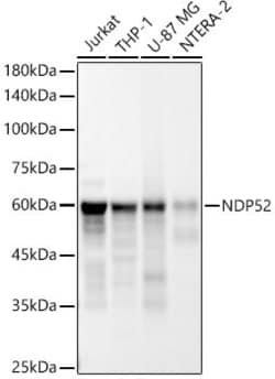 Invitrogen CALCOCO2 Recombinant Rabbit Monoclonal Antibody (10Q0T10) 100