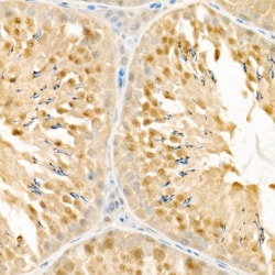 Invitrogen PSMC4 Recombinant Rabbit Monoclonal Antibody (5R9O10) 100 &mu;L;