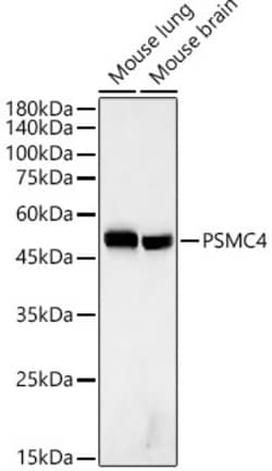 Invitrogen PSMC4 Recombinant Rabbit Monoclonal Antibody (5R9O10) 100 &mu;L;