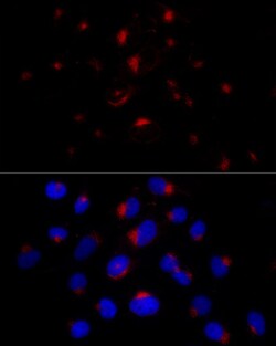 Invitrogen BST-2 Recombinant Rabbit Monoclonal Antibody (4L6O2) 100 &mu;L;