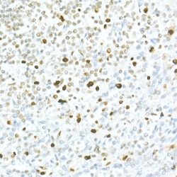 Invitrogen MCM2 Recombinant Rabbit Monoclonal Antibody (8E8O10) 100 &mu;L;