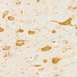 Invitrogen DARPP-32 Recombinant Rabbit Monoclonal Antibody (4F2O7) 100