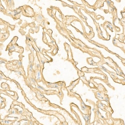 Invitrogen S100A10 Recombinant Rabbit Monoclonal Antibody (6A4Z3) 100 &mu;L;